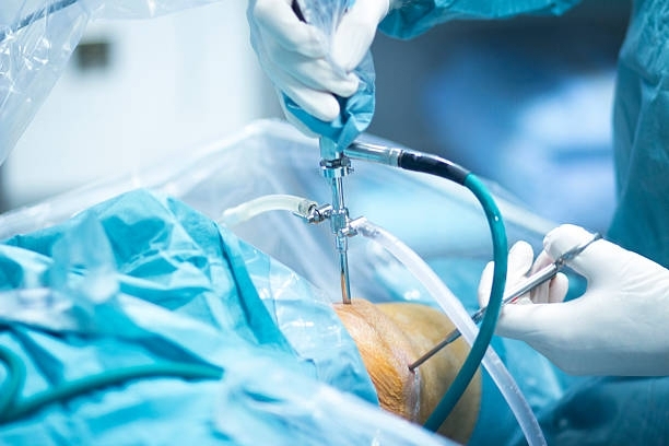 meniscus surgery to Dr. Dhawal Bakhda